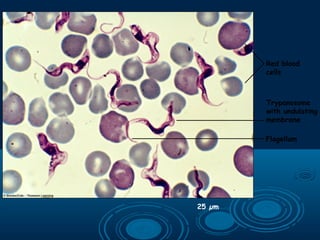 25 µm
Flagellum
Red blood
cells
Trypanosome
with undulating
membrane
 