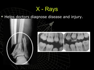 X - Rays


Helps doctors diagnose disease and injury.

 