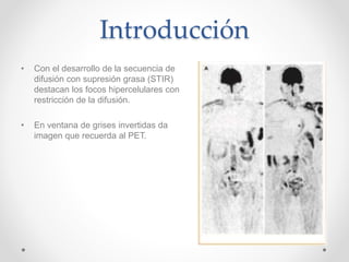 Introducción
• Con el desarrollo de la secuencia de
difusión con supresión grasa (STIR)
destacan los focos hipercelulares con
restricción de la difusión.
• En ventana de grises invertidas da
imagen que recuerda al PET.
 