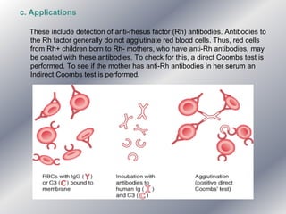 c. Applications
These include detection of anti-rhesus factor (Rh) antibodies. Antibodies to
the Rh factor generally do not agglutinate red blood cells. Thus, red cells
from Rh+ children born to Rh- mothers, who have anti-Rh antibodies, may
be coated with these antibodies. To check for this, a direct Coombs test is
performed. To see if the mother has anti-Rh antibodies in her serum an
Indirect Coombs test is performed.
 