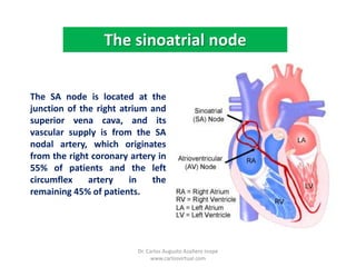 ThesinoatrialnodeThe SA node is located at the junction of the right atrium and superior vena cava, and its vascular supply is from the SA nodal artery, which originates from the right coronary artery in 55% of patients and the left circumflex artery in the remaining 45% of patients.Dr. Carlos Augusto Azañero Inope    www.carlosvirtual.com