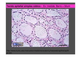 Tecido epitelial simples cúbico - Ex: tireóide. Barra = 50um
http://www.kumc.edu/instruction/medicine/anatomy/histoweb/epithel/epith
el.htm
 