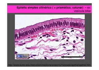 Epitélio simples cilíndrico ( = prismático, colunar) – ex:
vesícula biliar
http://www.kumc.edu/instruction/medicine/anatomy/histoweb/epithel/epithel.htm
 