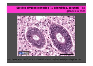 Epitélio simples cilíndrico ( = prismático, colunar) – ex:
glândula uterina
http://www.kumc.edu/instruction/medicine/anatomy/histoweb/epithel/epithel.htm
 