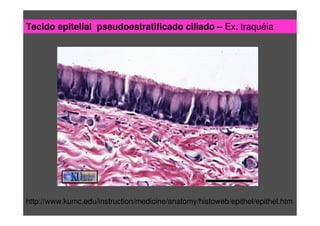 http://www.kumc.edu/instruction/medicine/anatomy/histoweb/epithel/epithel.htm
Tecido epitelial pseudoestratificado ciliado – Ex. traquéia
 