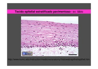 Tecido epitelial estratificado pavimentoso– ex: lábio
http://www.kumc.edu/instruction/medicine/anatomy/histoweb/epithel/epithel.htm
 