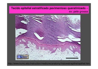 Tecido epitelial estratificado pavimentoso queratinizado –
ex: pele grossa
http://www.kumc.edu/instruction/medicine/anatomy/histoweb/epithel/epithel.htm
 