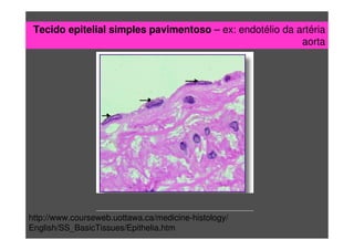 Tecido epitelial simples pavimentoso – ex: endotélio da artéria
aorta
http://www.courseweb.uottawa.ca/medicine-histology/
English/SS_BasicTissues/Epithelia.htm
 