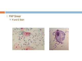 PAP Smear H and E Stain 