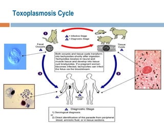 Toxoplasmosis Cycle 