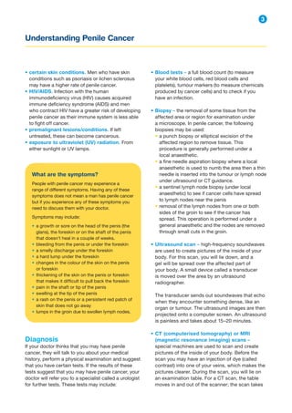 Understanding Penile Cancer
3
• certain skin conditions. Men who have skin
conditions such as psoriasis or lichen sclerosus
may have a higher rate of penile cancer.
• HIV/AIDS. Infection with the human
immunodeficiency virus (HIV) causes acquired
immune deficiency syndrome (AIDS) and men
who contract HIV have a greater risk of developing
penile cancer as their immune system is less able
to fight off cancer.
• premalignant lesions/conditions. If left
untreated, these can become cancerous.
• exposure to ultraviolet (UV) radiation. From
either sunlight or UV lamps.
• Blood tests – a full blood count (to measure
your white blood cells, red blood cells and
platelets), tumour markers (to measure chemicals
produced by cancer cells) and to check if you
have an infection.
• Biopsy – the removal of some tissue from the
affected area or region for examination under
a microscope. In penile cancer, the following
biopsies may be used:
• a punch biopsy or elliptical excision of the
affected region to remove tissue. This
procedure is generally performed under a
local anaesthetic.
• a fine needle aspiration biopsy where a local
anaesthetic is used to numb the area then a thin
needle is inserted into the tumour or lymph node
under ultrasound or CT guidance.
• a sentinel lymph node biopsy (under local
anaesthetic) to see if cancer cells have spread
to lymph nodes near the penis
• removal of the lymph nodes from one or both
sides of the groin to see if the cancer has
spread. This operation is performed under a
general anaesthetic and the nodes are removed
through small cuts in the groin.
• Ultrasound scan – high-frequency soundwaves
are used to create pictures of the inside of your
body. For this scan, you will lie down, and a
gel will be spread over the affected part of
your body. A small device called a transducer
is moved over the area by an ultrasound
radiographer.
The transducer sends out soundwaves that echo
when they encounter something dense, like an
organ or tumour. The ultrasound images are then
projected onto a computer screen. An ultrasound
is painless and takes about 15–20 minutes.
• CT (computerised tomography) or MRI
(magnetic resonance imaging) scans –
special machines are used to scan and create
pictures of the inside of your body. Before the
scan you may have an injection of dye (called
contrast) into one of your veins, which makes the
pictures clearer. During the scan, you will lie on
an examination table. For a CT scan, the table
moves in and out of the scanner; the scan takes
What are the symptoms?
People with penile cancer may experience a
range of different symptoms. Having any of these
symptoms does not mean a man has penile cancer
but if you experience any of these symptoms you
need to discuss them with your doctor.
Symptoms may include:
• a growth or sore on the head of the penis (the
glans), the foreskin or on the shaft of the penis
that doesn’t heal in a couple of weeks.
• bleeding from the penis or under the foreskin
• a smelly discharge under the foreskin
• a hard lump under the foreskin
• changes in the colour of the skin on the penis
or foreskin
• thickening of the skin on the penis or foreskin
that makes it difficult to pull back the foreskin
• pain in the shaft or tip of the penis
• swelling at the tip of the penis
• a rash on the penis or a persistent red patch of
skin that does not go away
• lumps in the groin due to swollen lymph nodes.
Diagnosis
If your doctor thinks that you may have penile
cancer, they will talk to you about your medical
history, perform a physical examination and suggest
that you have certain tests. If the results of these
tests suggest that you may have penile cancer, your
doctor will refer you to a specialist called a urologist
for further tests. These tests may include:
 