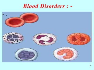 Blood Disorders : -
34
• .
 