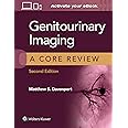 Genitourinary Imaging: A Core Review