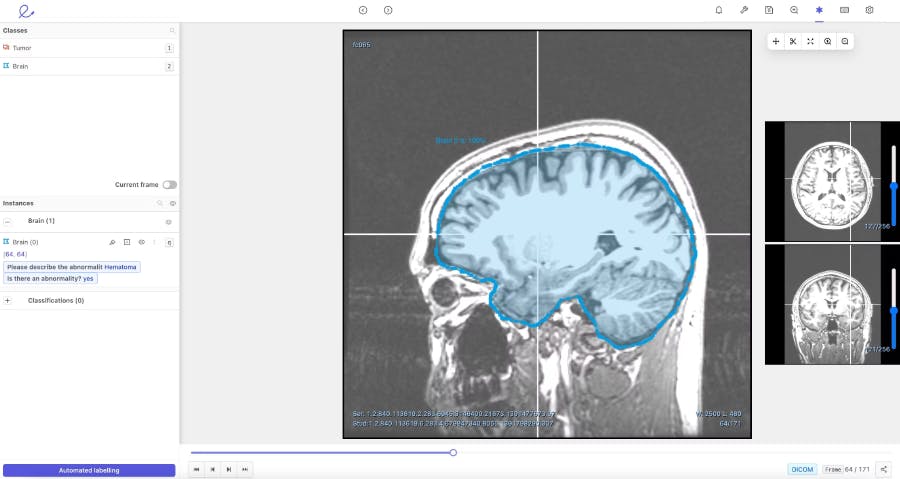 sampleImage_computer-vision-role-in-cancer-treatment