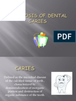 Diagnosis of Dental Caries