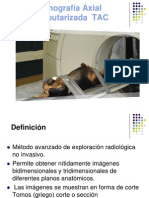 Tomografía Axial Computarizada TAC