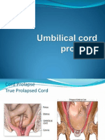 Umbilical Cord Prolapse