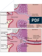 Preeclampsia