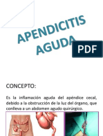 Apendicitis Aguda