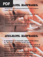 Uterine Rupture