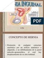 Hernia Inguinal