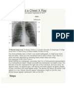 How To Read A Chest X Ray