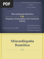 Miocardiopatia Restritiva e Displasia Arritmogénica Do Ventrículo Direito