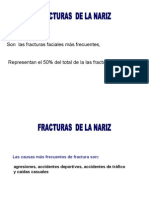 Fractura Nasal