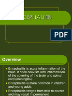 Encephalitis 