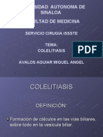 Colelitiasis