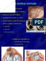 7-Valvulopatii Aortice Presented