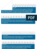 ECG Readings