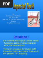 Impacted Teeth