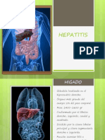 Hepatitis