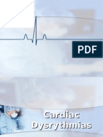 Cardiac Dysrythmias