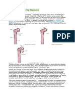 Intertrochanteric Fracture