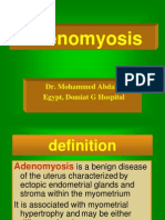 Adenomyosis