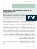 Pulp Revascularization of A Necrotic Infected Immature Permanent Tooth: Case Report and Review of The Literature