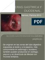 Ulceras Gastrica y Duodenal