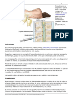 Puncion Lumbar