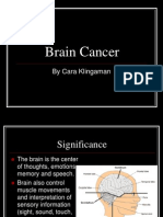 Brain Cancer: by Cara Klingaman