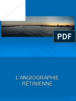 L'angiographie Rétiniene