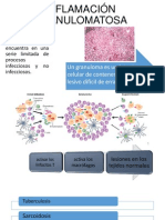 Inflamación Granulomatosa