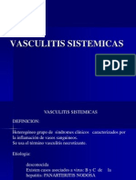 Vasculitis