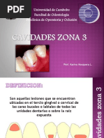 Cavidades Zona 3