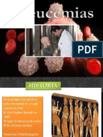 Leucemia Exposicion