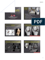 Imaging Anterior Cruciate Ligament Tear - Helpful Tips Imaging Anterior Cruciate Ligament Tear - Helpful Tips