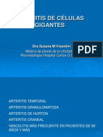 Arteritis de Celulas Gigantes