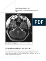 Cerebellar Disorders