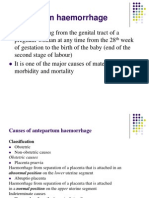 Antepartum Haemorrhage